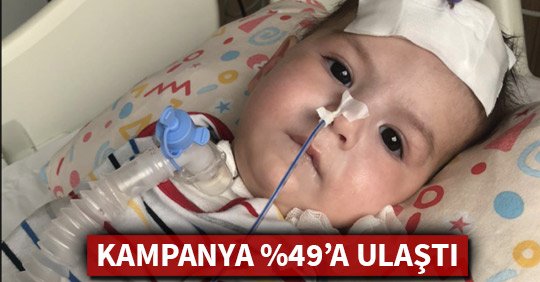 MİRZA BEBEĞİN KAMPANYASI YÜZDE 49’A ULAŞTI